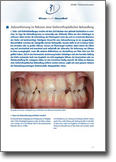 Zahnentfernung-Kieferorthopaedie-dgzmk.pdf